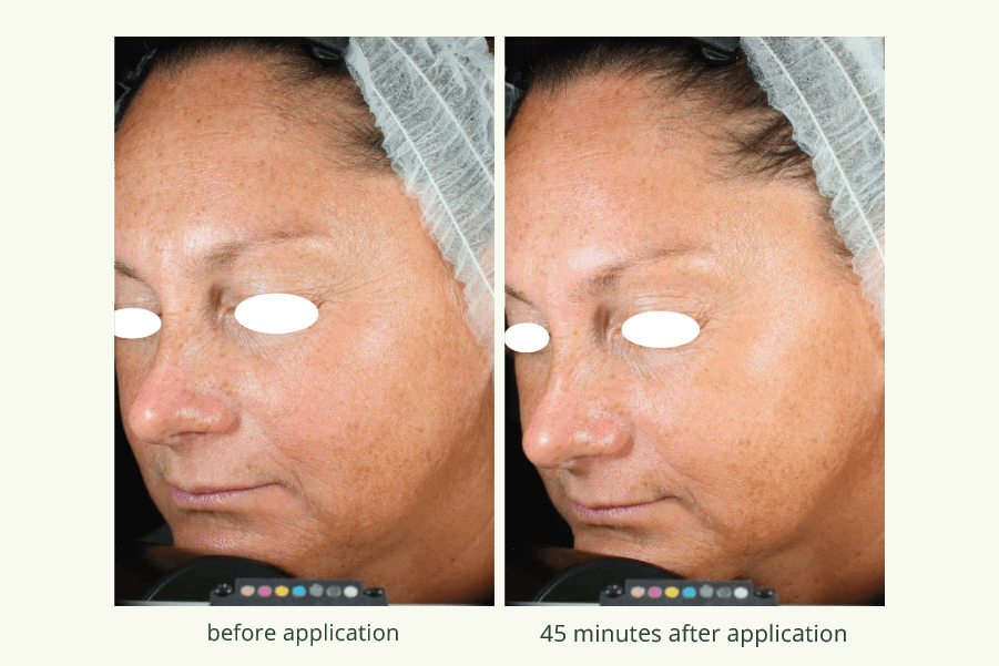 Collagene Vegetale 2