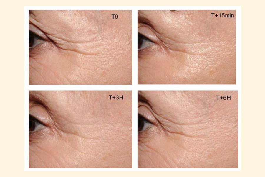 ECOFERMENTATO ATTIVATORE EFFETTI RUGHE