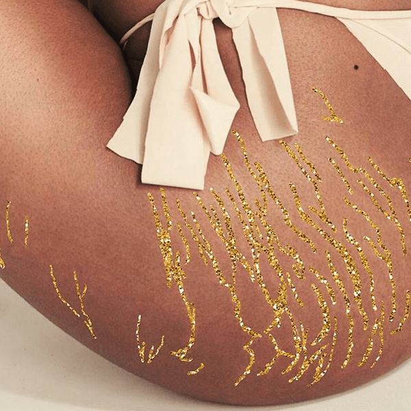 Smagliature Oro 1200x1200